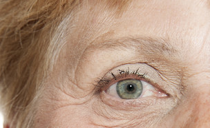 קמטים מסביב לעין (צילום: Kuttelvaserova Stuchelova, Shutterstock)