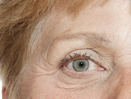 קמטים מסביב לעין (צילום: Kuttelvaserova Stuchelova, Shutterstock)
