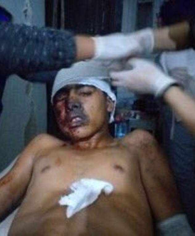 פצוע כורדי בסוריה