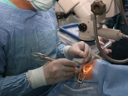 ניתוח עין (צילום:  mehmetcan, shutterstock)