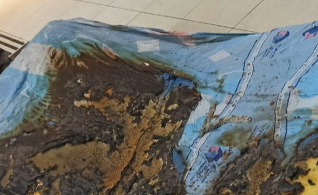 המצוקה במיון: מטופל הצית את המיטה