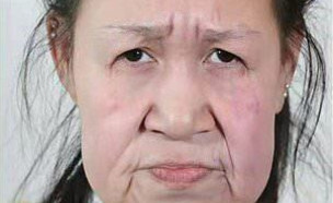 השתלת פנים (צילום: Shenyang Sunline Plastic Surgery Hospital, טוויטר\@mayankg406, )