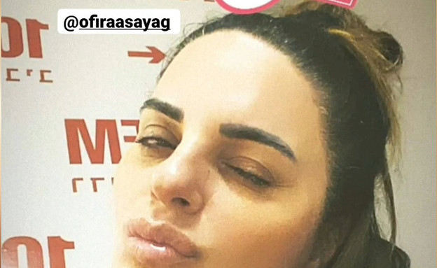פילטר האינסטגרם הרשמי של חתונה ממבט ראשון