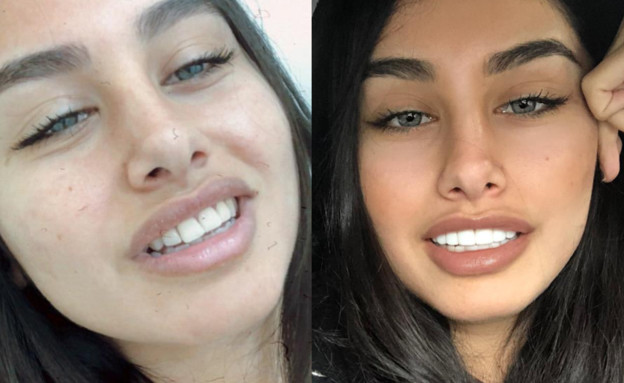 מגי טביבי עשתה שינוי בשיניים (צילום: אלון חן, פרטי)