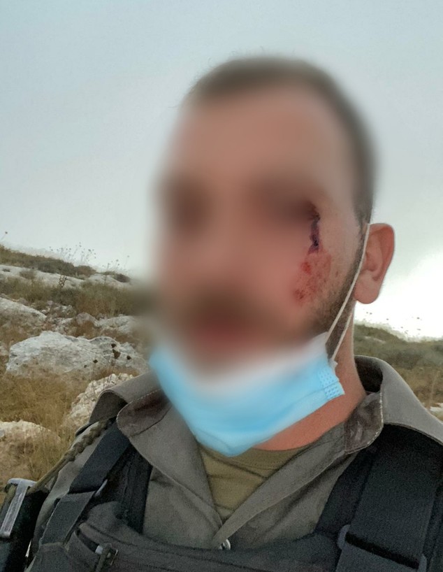 לוחם מג"ב שנפצע ביצהר (צילום: דוברות המשטרה)