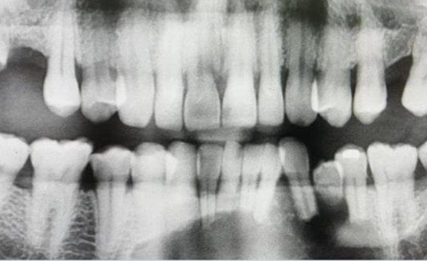 דארן וילקינסון, לא ביקר אצל רופא שיניים 27 שנים (צילום: twitter)