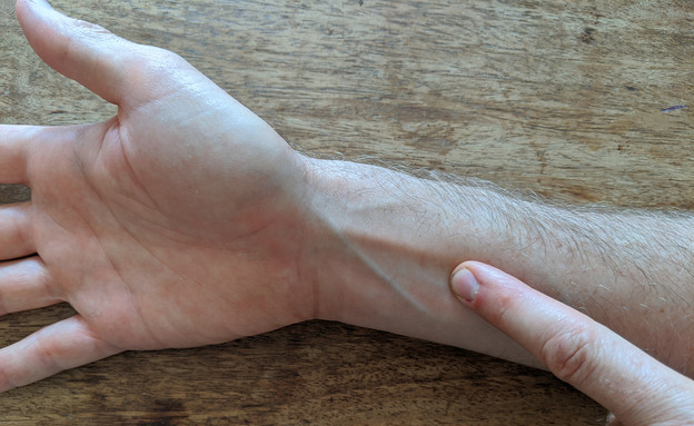 רוחב שלוש אצבעות מעל למפרק   כף היד (צילום: נתלי פינשטיין)
