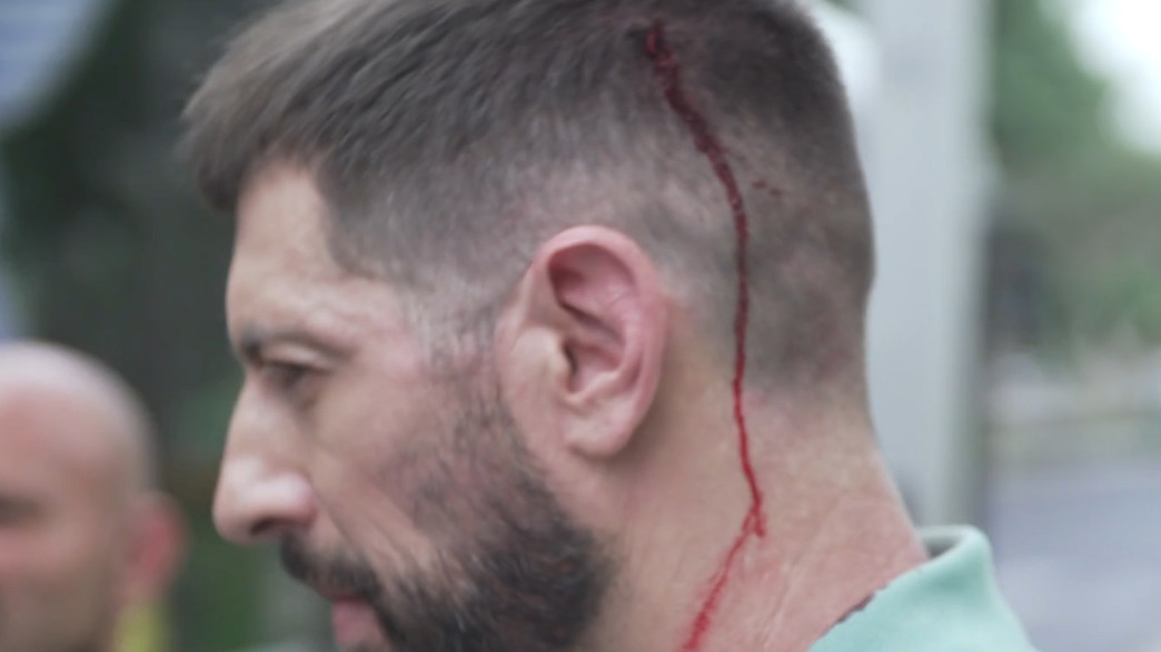 המרדף הדרמטי אחרי הטכנאי הסתיים בפציעה