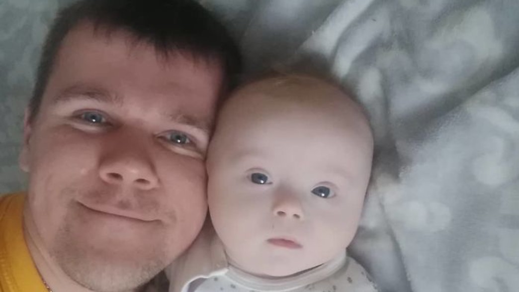 תסמונת דאון