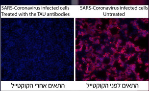 חוקרים פיתחו קוקטייל נוגדנים כתרופה לקורונה (צילום: מתוך "חדשות הבוקר" , קשת12)