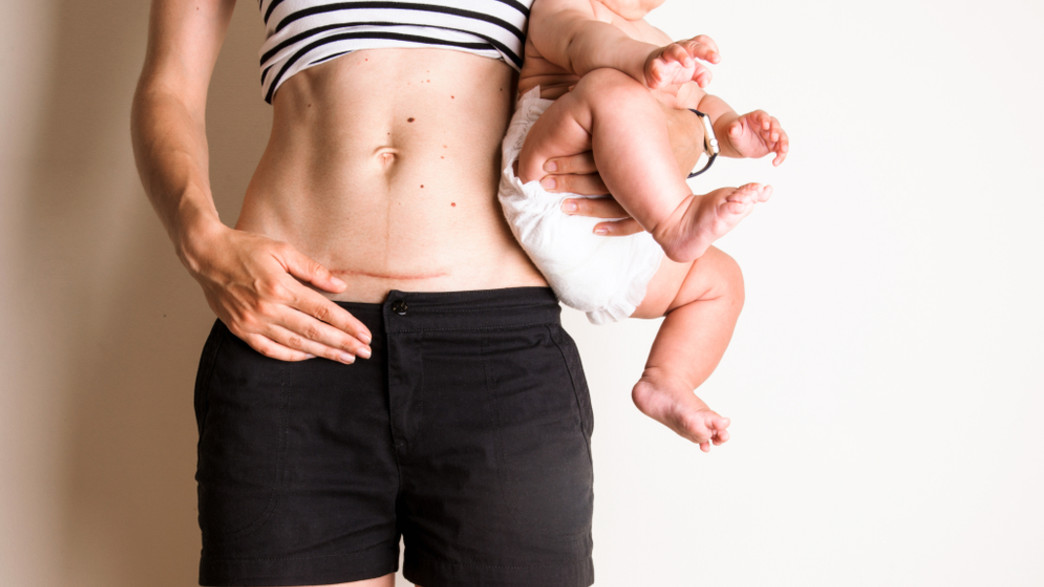 אישה אחרי לידה