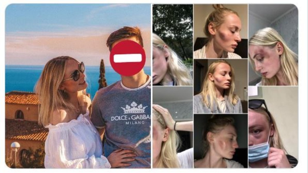 אנטוניה רוצ'ז