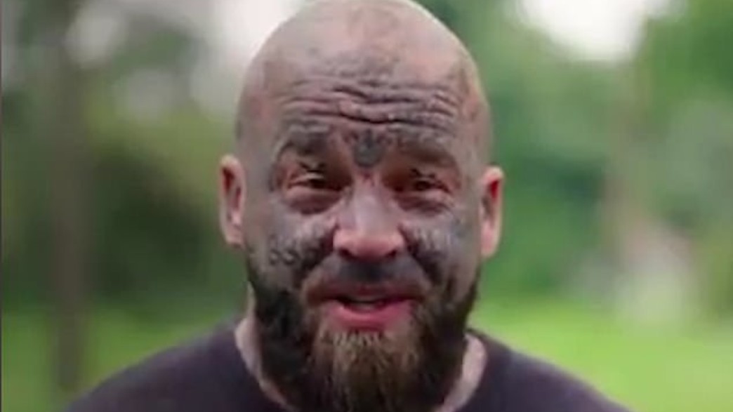 משתתף בריאלי בריטי שפניו מכוסות בקעקועים ניאו נאצי משתתף בריאלי בריטי שפניו מכוסות בקעקועים ניאו נאצי