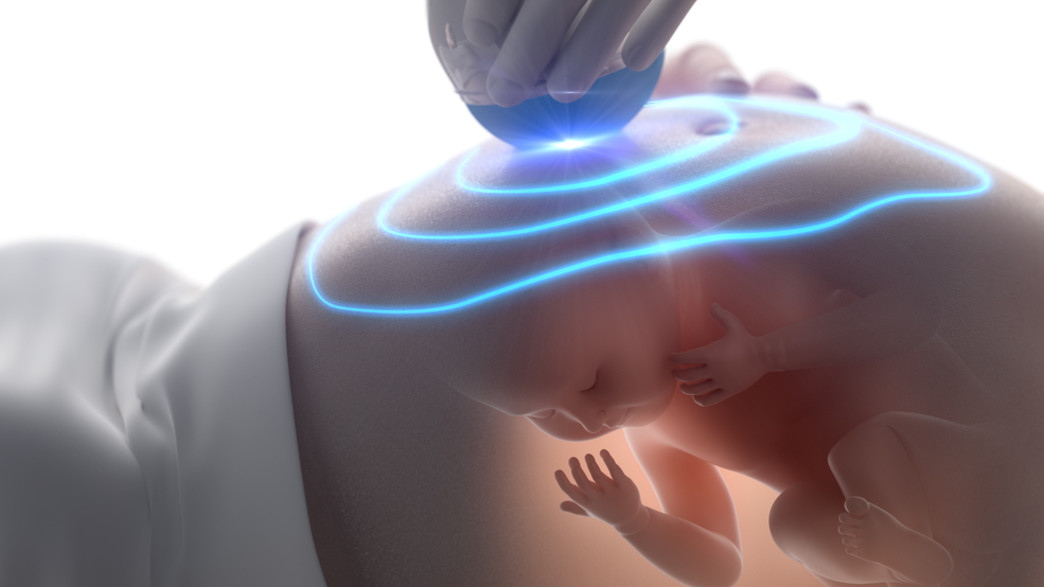 עובר בבטן הריון אולטרסאונד