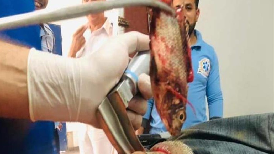 דייג בלע דג חי שלם