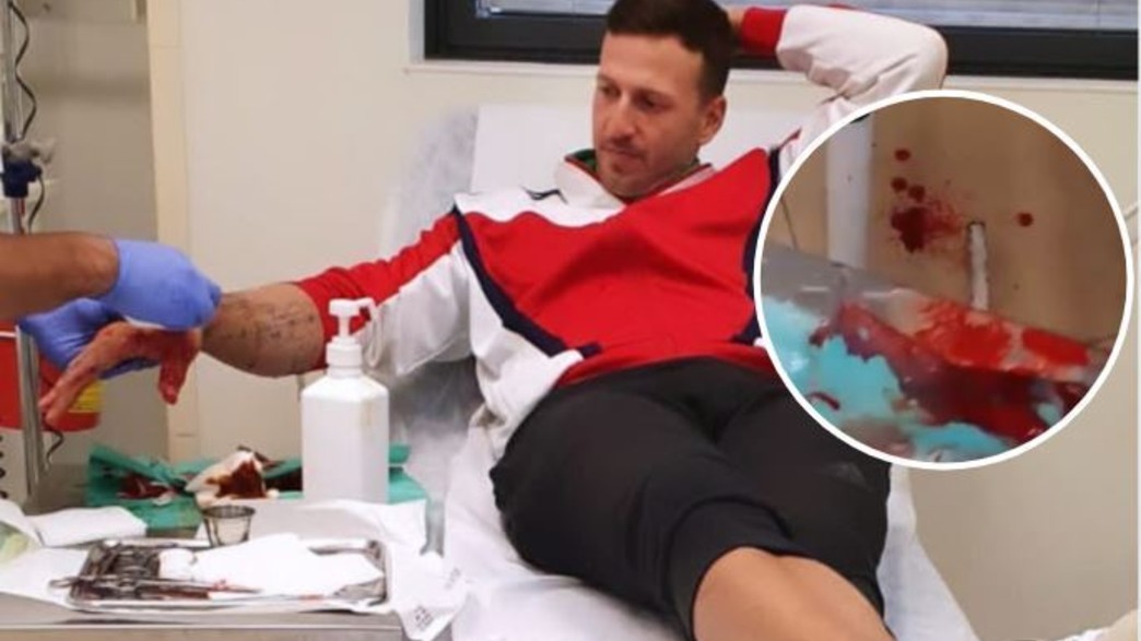 מייקל לואיס בבית חולים