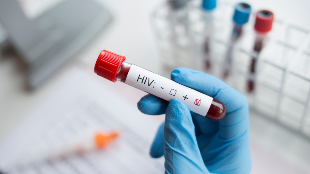 HIV (אילוסטרציה: forma82, shutterstock)