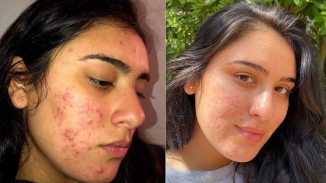 אנג'ליקה דיאז 