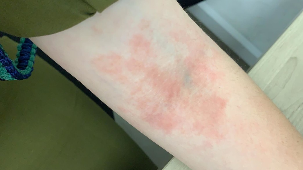 היד של החיילת היד של החיילת