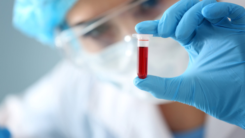 המטולוגיה המטולוגיה