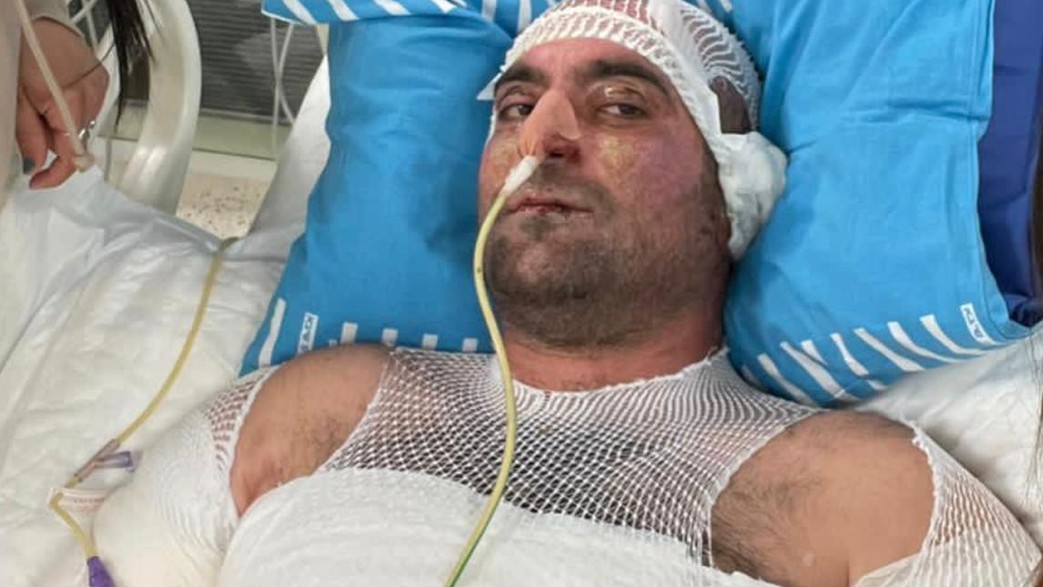 יניב אימנילוב שהוצת לפי החשד ע"י בת זוגו לשעבר