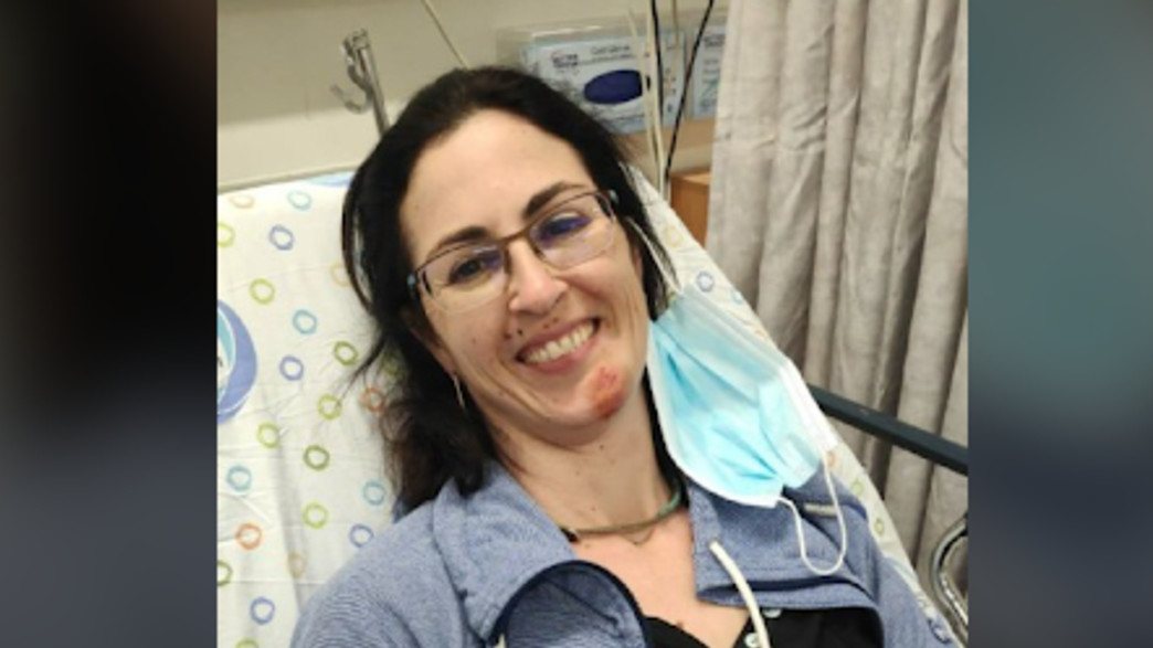 יעל שנפצעה בינוני מפגיעת חזיר בר בכרמל 