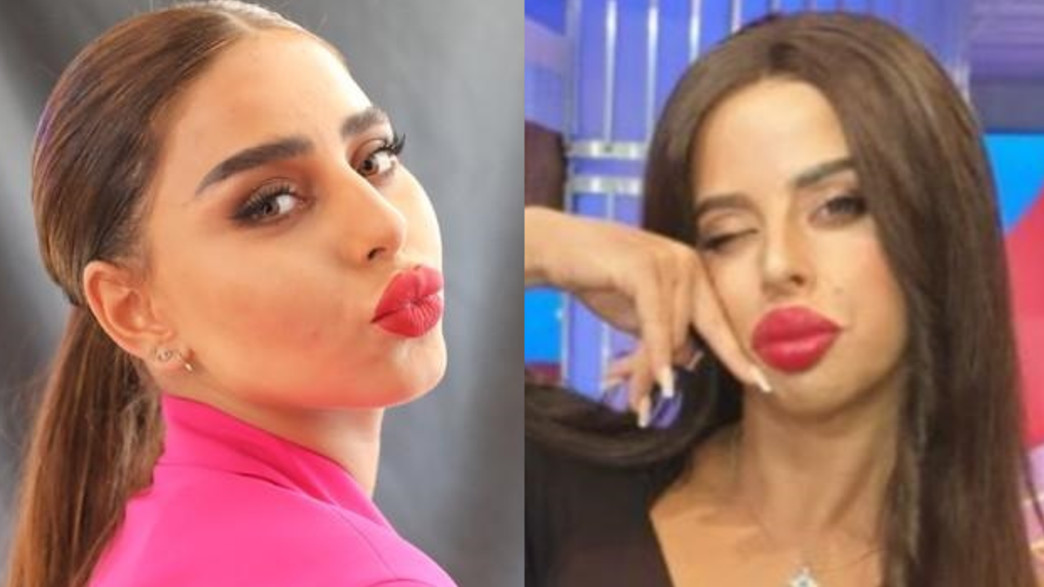 אלין כהן מגיבה לחיקוי בארץ נהדרת אלין כהן מגיבה לחיקוי בארץ נהדרת