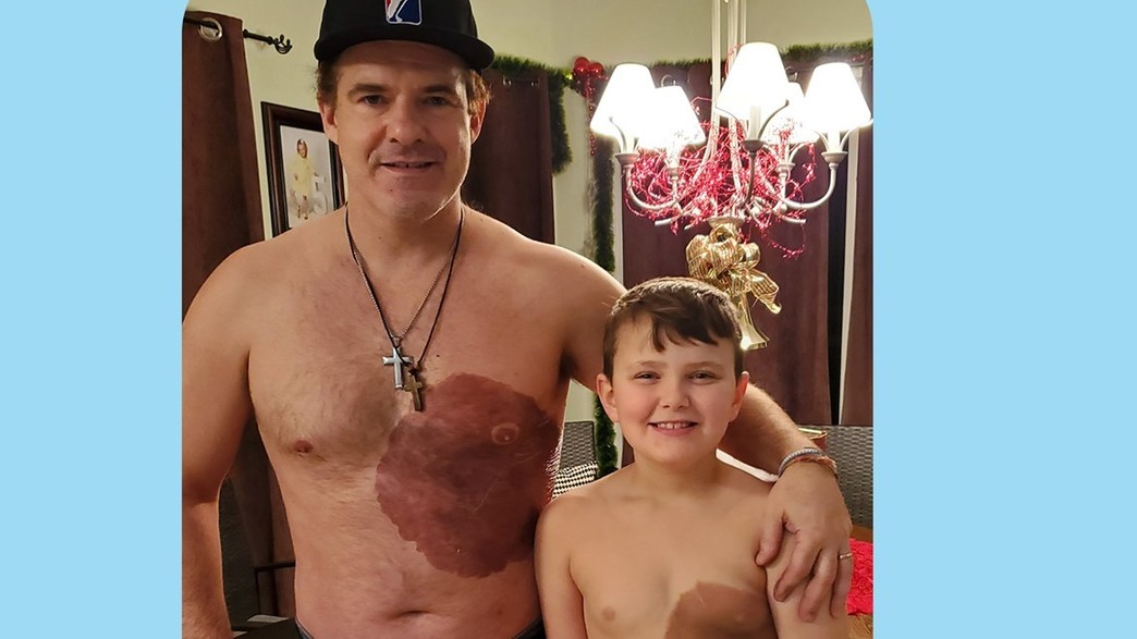 אבא קעקע את עצמו לפי כתם הלידה של בנו