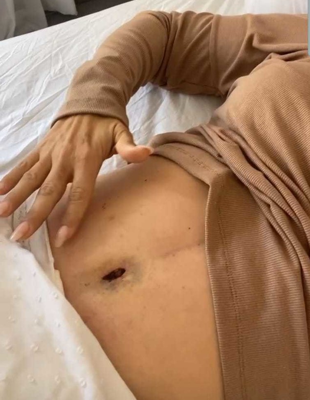 ליהיא גרינר חושפת בטן אחרי הניתוח, ינואר 2021 (צילום: מתוך האינסטגרם של ליהיא גרינר, מתוך instagram)