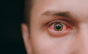 עין אדומה (צילום: ViDI Studio, Shutterstock)