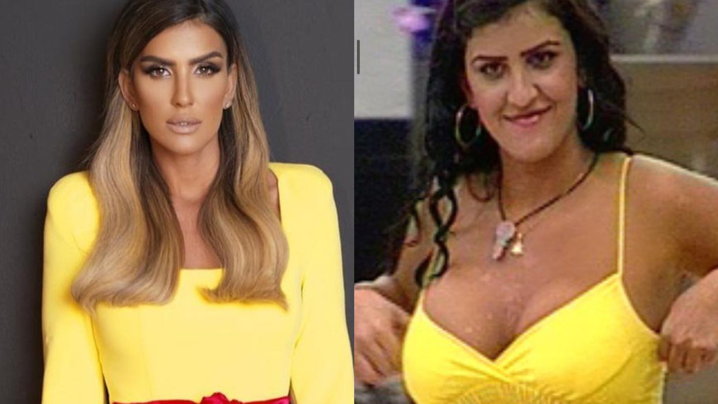 עינב בובליל לפני ואחרי. מרץ 2021 עינב בובליל לפני ואחרי. מרץ 2021