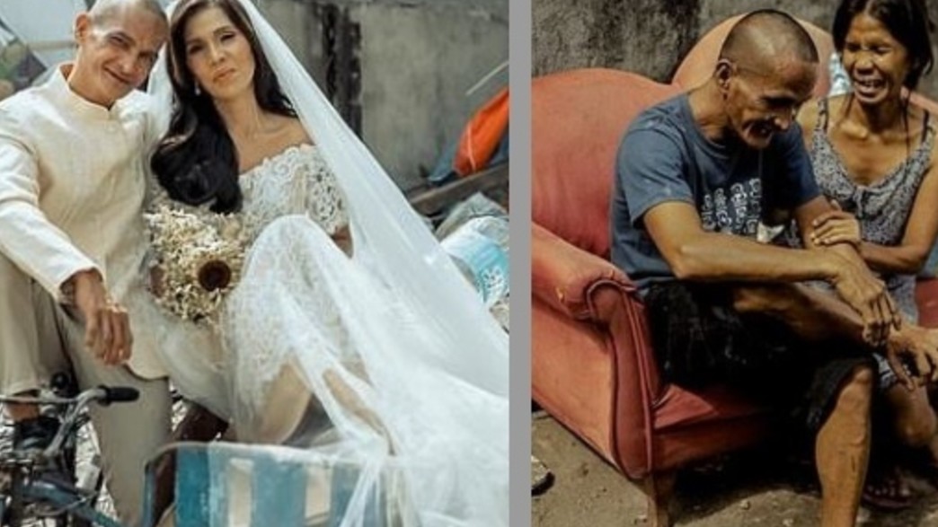 רוזלין פרר ורומל בסקו לפני ואחרי רוזלין פרר ורומל בסקו לפני ואחרי