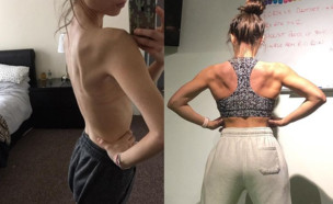 קייסי ליס סמית' לפני ואחרי  (צילום: caseyleessmith, instagram)
