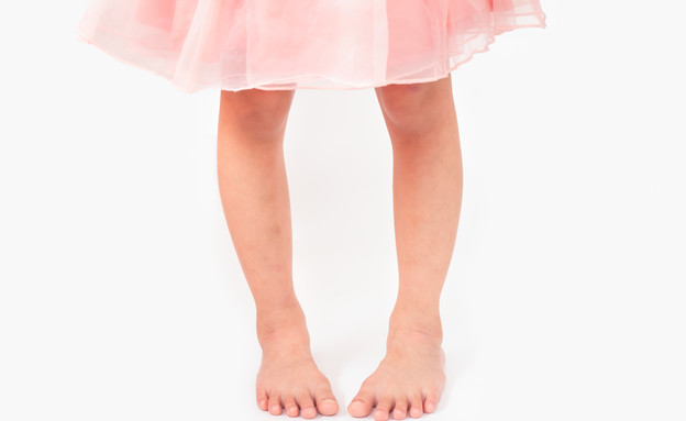 רגליים עקומות בילדים (צילום: Arlee.P, shutterstock)