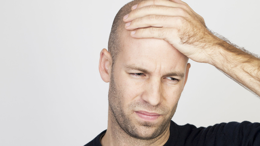 בחור צעיר קירח