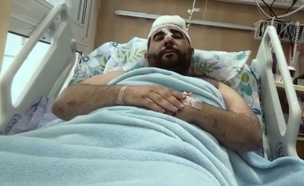 מור גאנאשווילי, פצוע הלינץ' בעכו (צילום: חדשות 12)