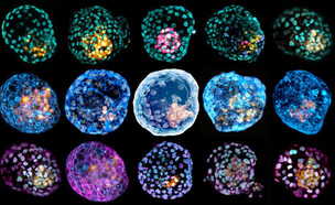 בלסטואידים שהתאים שלהם צבועים בצבעים שונים (צילום: Monash University)