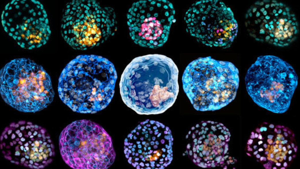 בלסטואידים שהתאים שלהם צבועים בצבעים שונים (צילום: Monash University)