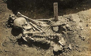 נמצאה סיבת מוות בן 3,000 שנים (צילום: אוניברסיטת קיוטו)