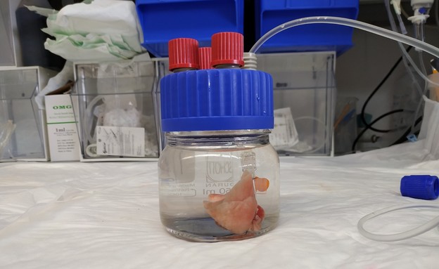 חוקרים פיתחו דרך להשתלת איברים מבעלי חיים (צילום: בית החולים בילינסון)