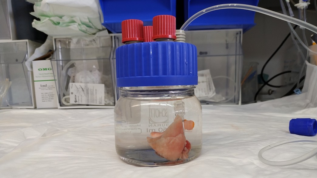 חוקרים פיתחו דרך להשתלת איברים מבעלי חיים