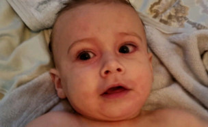 תינוק קיבל התקף אלרגיה קשה, אחותו סייעה (צילום: מתוך "חדשות הבוקר" , קשת12)