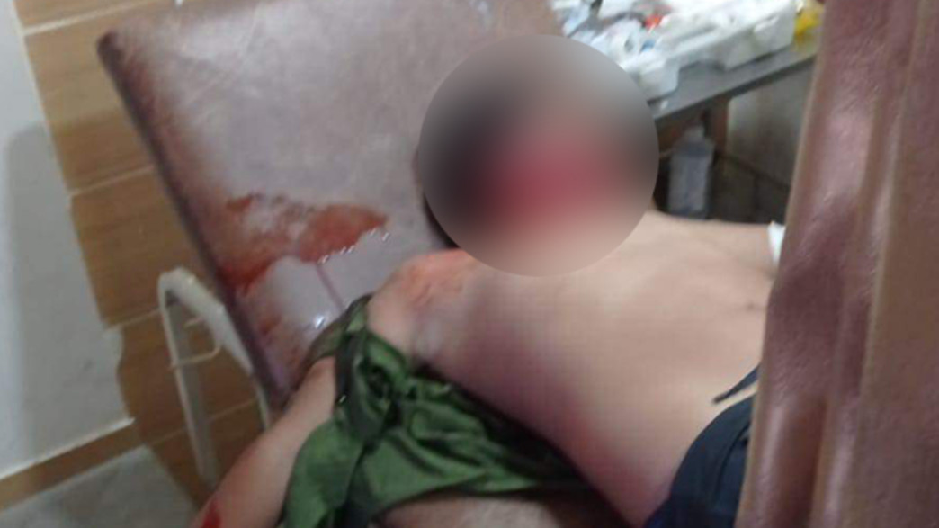 ילד פלסטיני בן 10 נהרג מאש צה"ל מזרחית לחברון