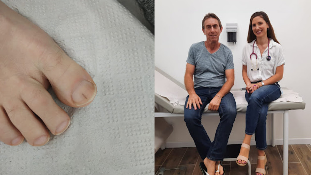 המטופל ירון פרי והכתם על הציפורן המטופל ירון פרי והכתם על הציפורן