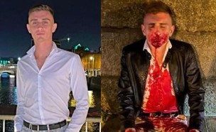 ג'ק וולי, לפני ואחרי התקיפה (צילום: מתוך עמוד האינסטגרם jack_woolley_tkd@, instagram)