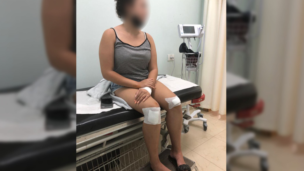 החבלות שנגרמו לנערה מהמעצר