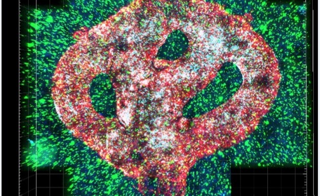 צילום מיקרוסקופי של מודל הגליובלסטומה המודפס בתלת מימד  (צילום: אוניברסיטת ת"א)