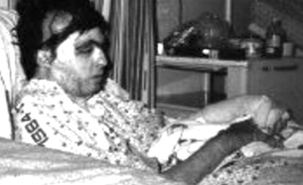  דן אריאלי בן ה-17 במחלקת כוויות בשיבא