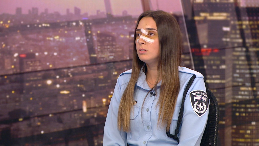 השוטרת שהותקפה באלימות בריאיון ראשון: "עדיין כואב" 