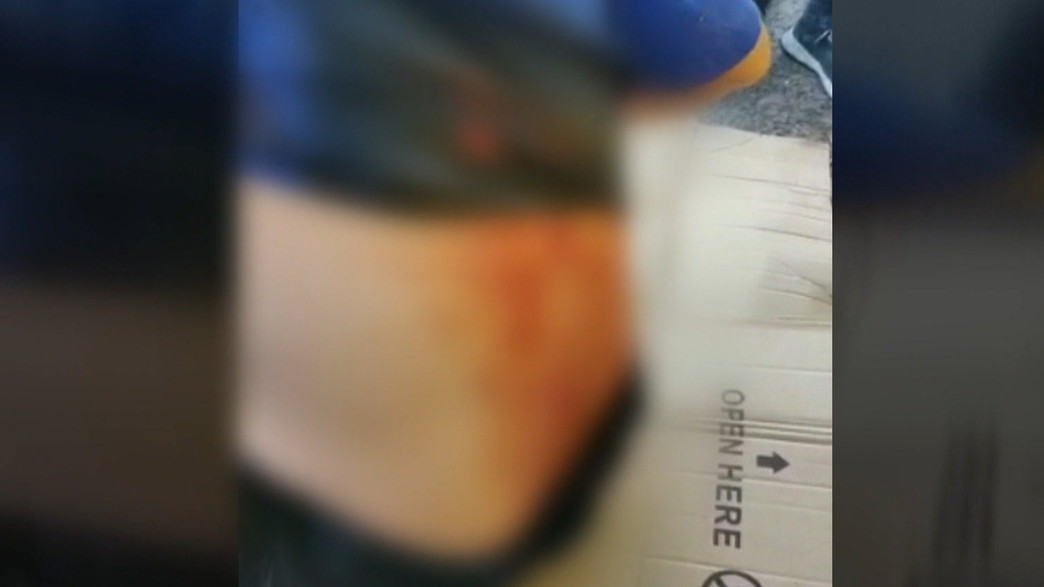 נהג אוטובוס שנדקר בירושלים